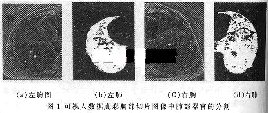 基于区域增长的可视人彩色图像分割